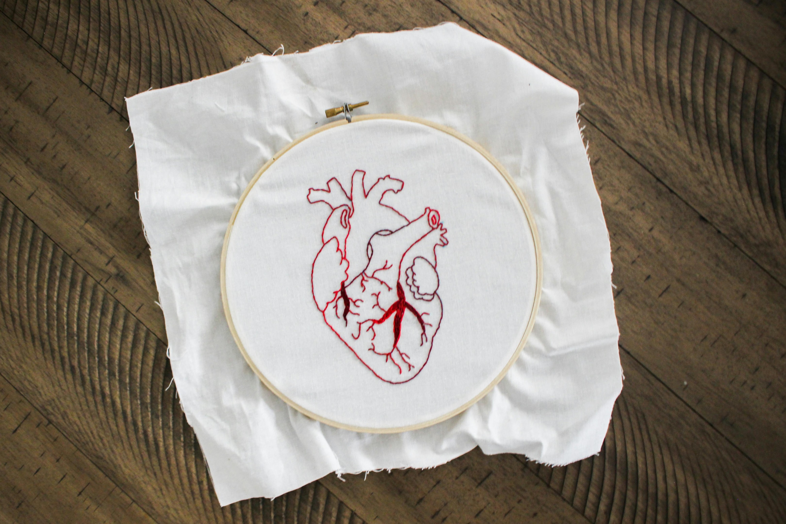 heart replacement cost